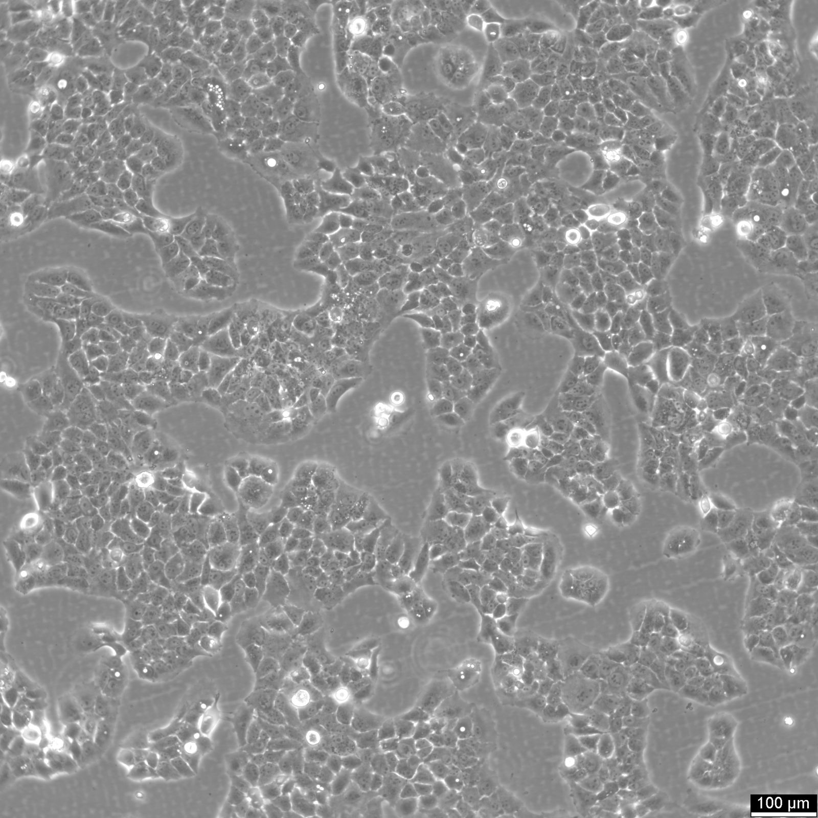 MS751 Cells