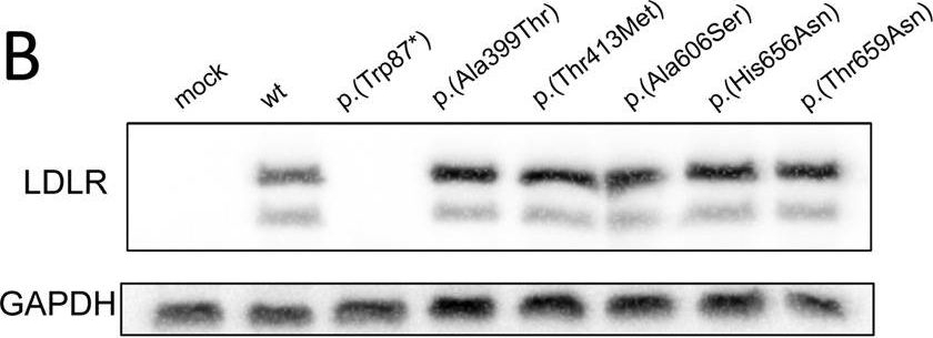 Mutation type classification and pathogenicity assignment of sixteen missense variants located in the EGF-precursor homology domain of the LDLR.