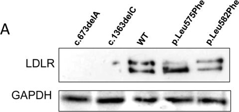 The use of targeted exome sequencing in genetic diagnosis of young patients with severe hypercholesterolemia.