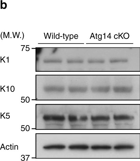 Beclin 1 regulates recycling endosome and is required for skin development in mice.