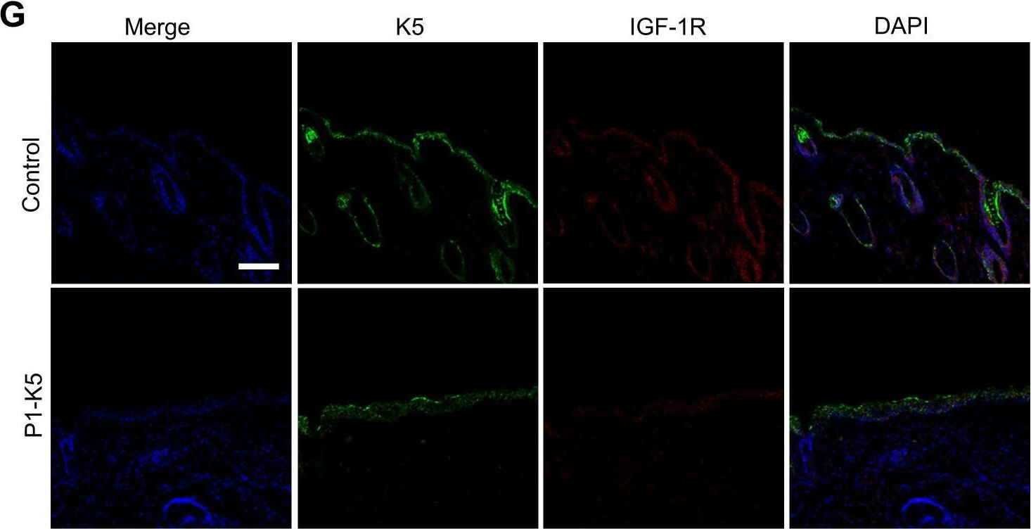 PINCH-1 promotes IGF-1 receptor expression and skin cancer progression through inhibition of the GRB10-NEDD4 complex.