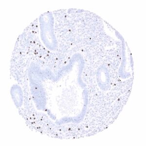 Uterus, endometrium (proliferation) - In the endometrium, CD3 positive T-lymphocytes are regularly seen